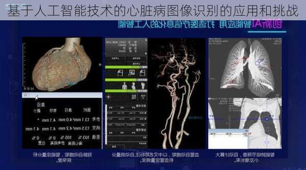 基于人工智能技术的心脏病图像识别的应用和挑战