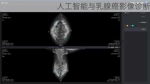 人工智能与乳腺癌影像诊断